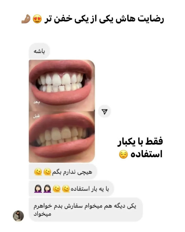 رضایت مشتری از سفید کننده دندان لنبنا مدل اسنس